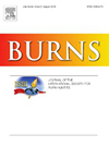 BURNS雜志封面